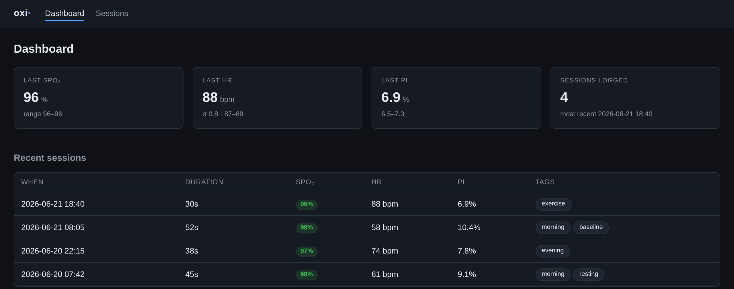 oxi dashboard — SpO₂, heart-rate and perfusion-index tiles with a recent-sessions table